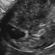 Illustration for article titled No Longer Viable: Purging the Pain of My Miscarriages